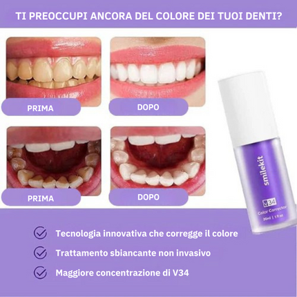 Sbiancante Dentale V34™ - TRENDFINDER® (2025) ⭐⭐⭐⭐⭐