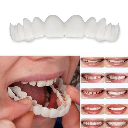 Faccette Dentali - Sorridi di nuovo con sicurezza
