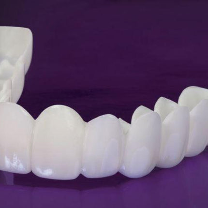 Faccette Dentali - Sorridi di nuovo con sicurezza